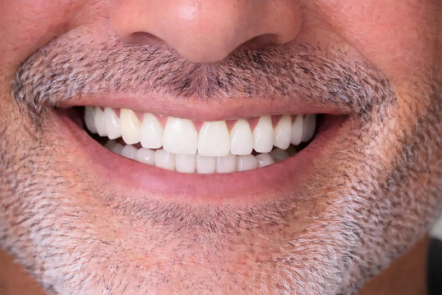 After treatment